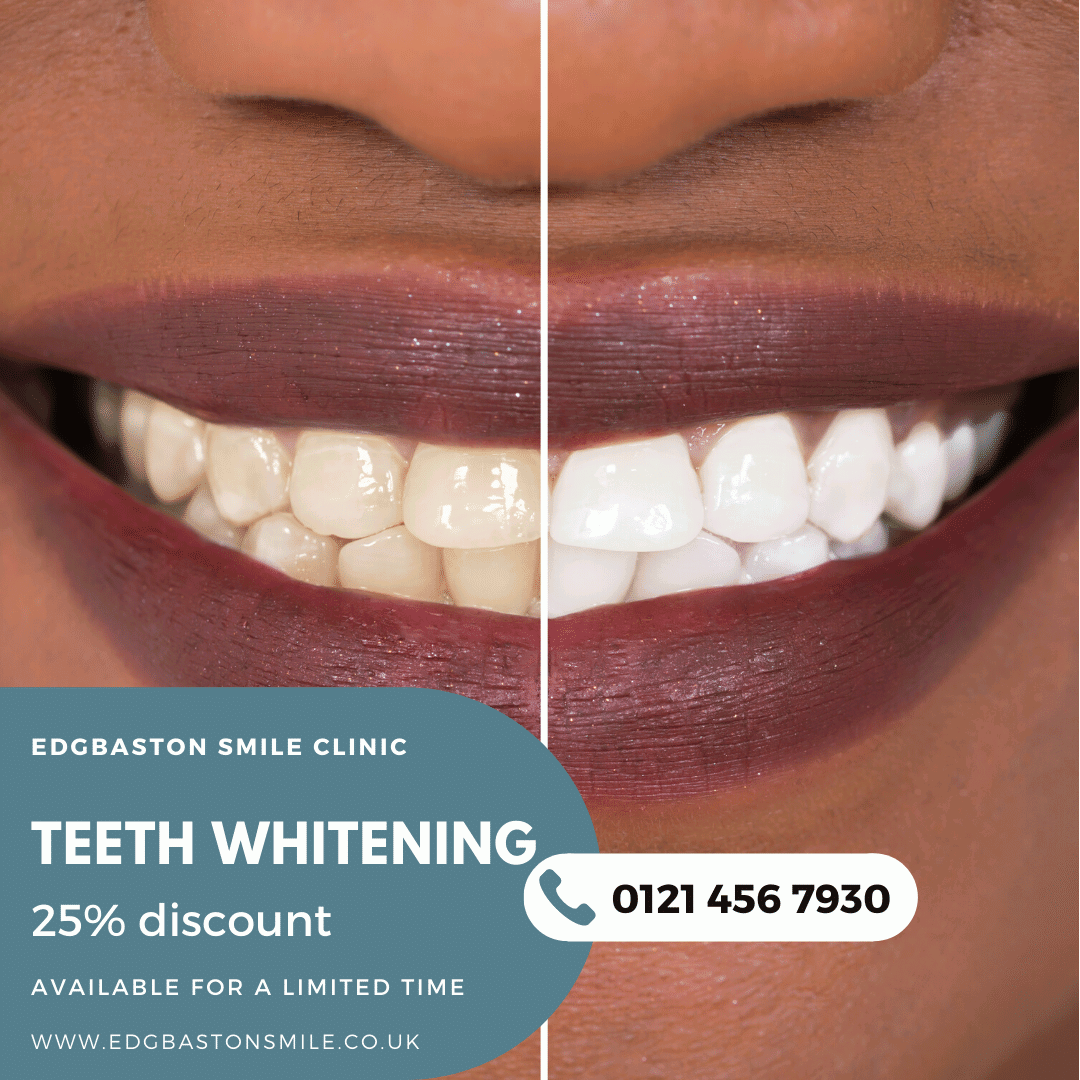 25% off teeth whitening