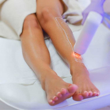 Laser Hair Removal in Birmingham Kat Co